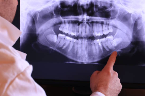 Best Chipped Tooth Repair Near Me  in Solon, OH